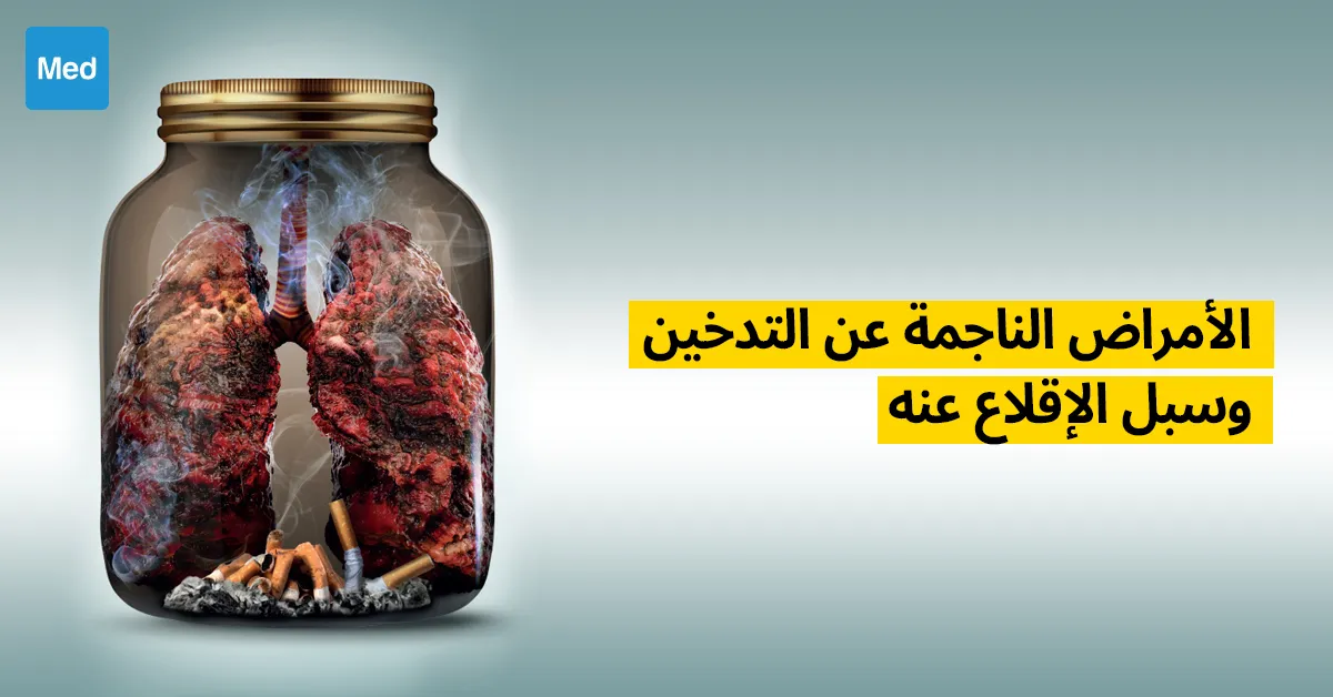 الأمراض الناجمة عن التدخين وسبل الإقلاع عنه